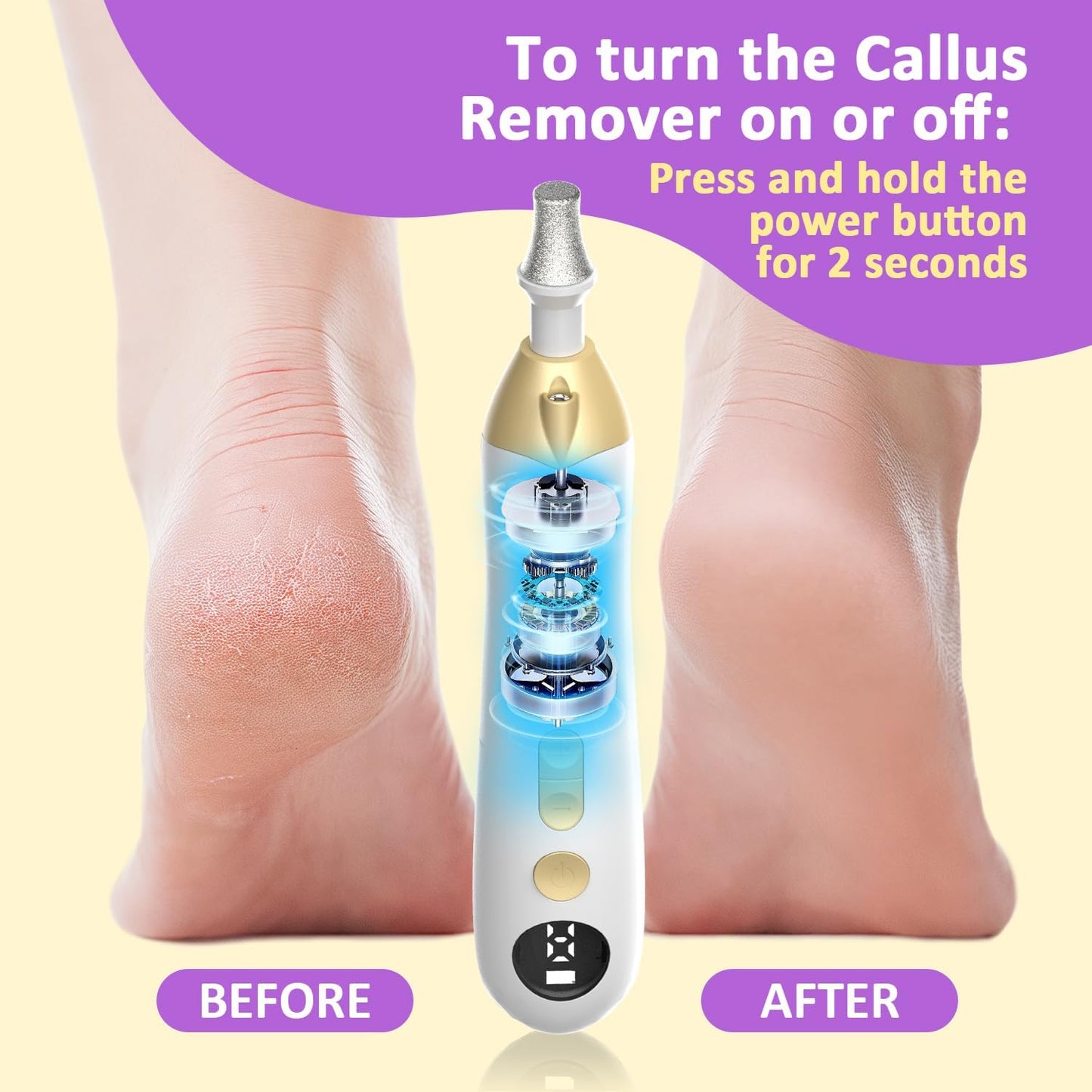 Callus Remover for Feet, Electric Foot Callus Remover - 8 Grinding Heads, 9 Speeds, Rechargeable Foot File - Professional Pedicure Tool for Hard Skin, Calluses & Cracked Feet