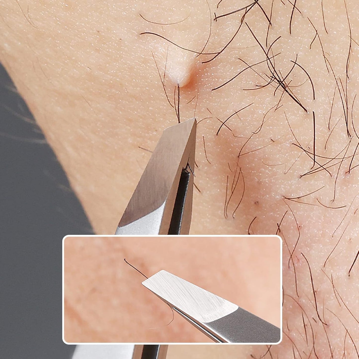 Eyebrow Hair Removal Tweezers, Slant Tweezer Handmade Professional Eyebrow Facial & Hair Remover Better closure Stainless Steel