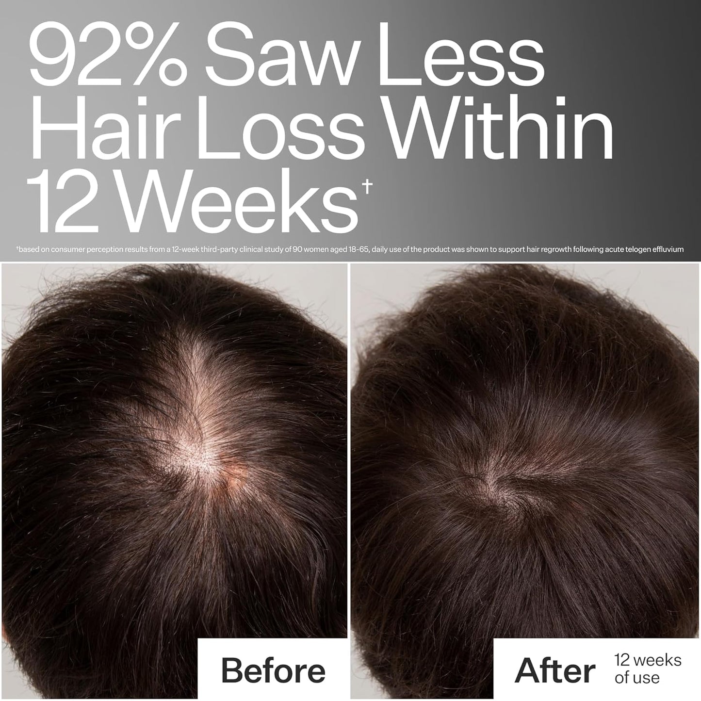 Act+Acre Cold Processed 3% Stem Cell Peptide Treatment | Boosts Hair Density | Grape Stem Cells, Peptides + Caffeine | Vegan, Fragrance-Free | 3 Fl Oz