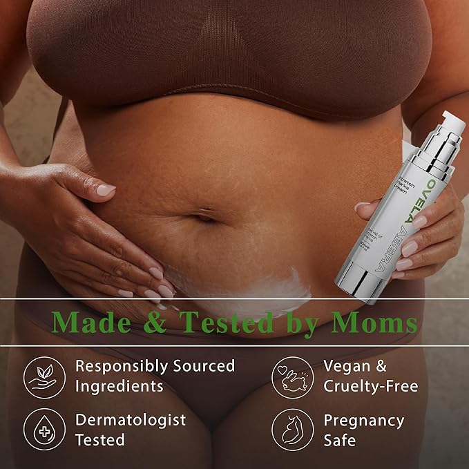 Abera Ovela Maternity Stretch Mark Cream for Pregnancy and Weight Fluctuations, Stretch Mark Treatment Pregnancy Must Haves, Deep Stretch Mark Removal, All Skin Types, 1.69 fl oz, Set of 3