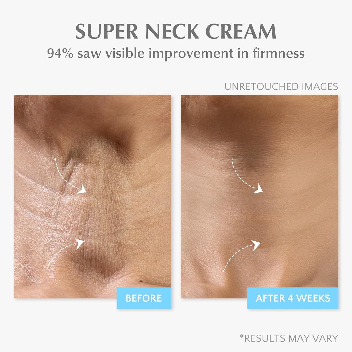 Retinol Anti Aging Face Moisturizer: Wrinkle Cream for Women, Collagen Day Night Repair Cream - Firming, Tightening & Lifting Neck Sagging Skin, 7% Hyaluronic Acid for Max Hydration, 1.7 Oz