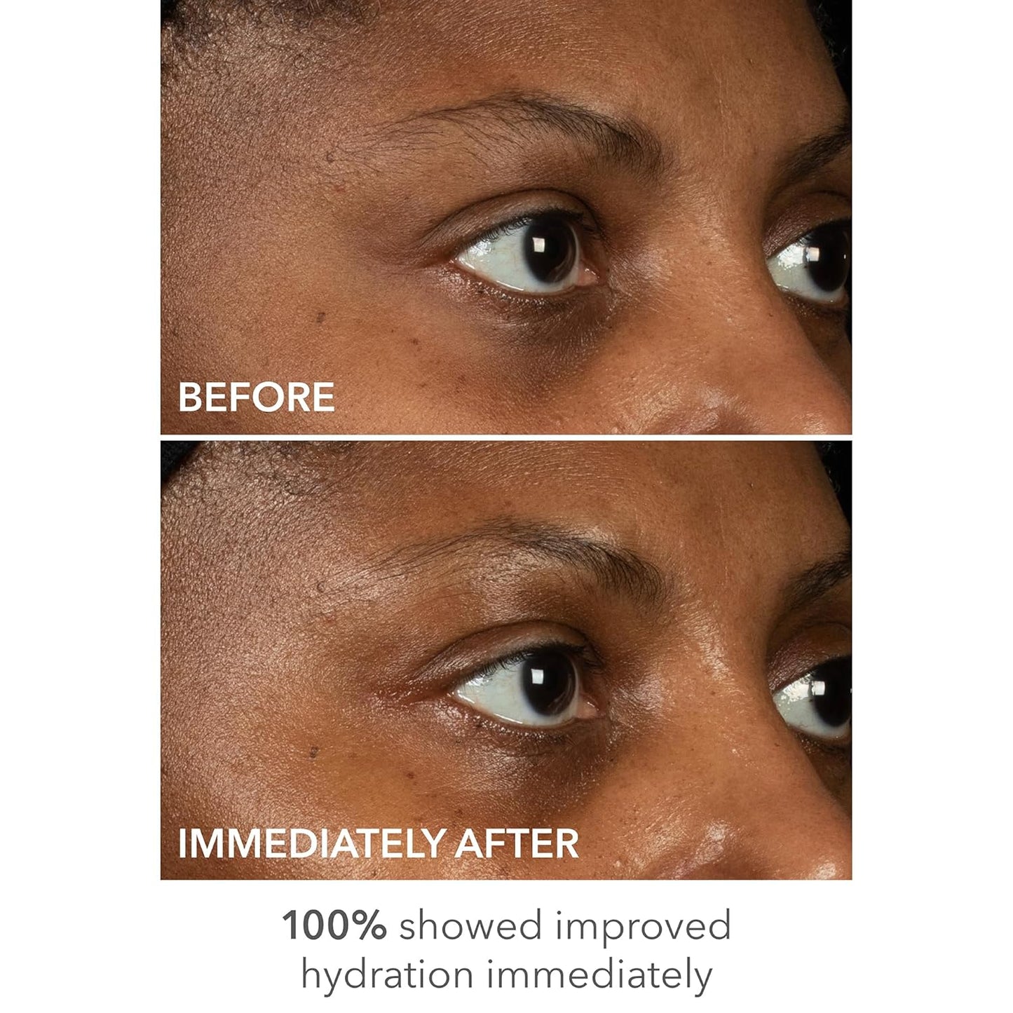 Dr Dennis Gross DermInfusions Lift + Repair Eye Mask | Visibily Lift + Firm, Fills the Appearance of Fine Lines, Deepy Hydrates + Repairs, Visibly Depuffs the Undereye Area | 4 Treatments