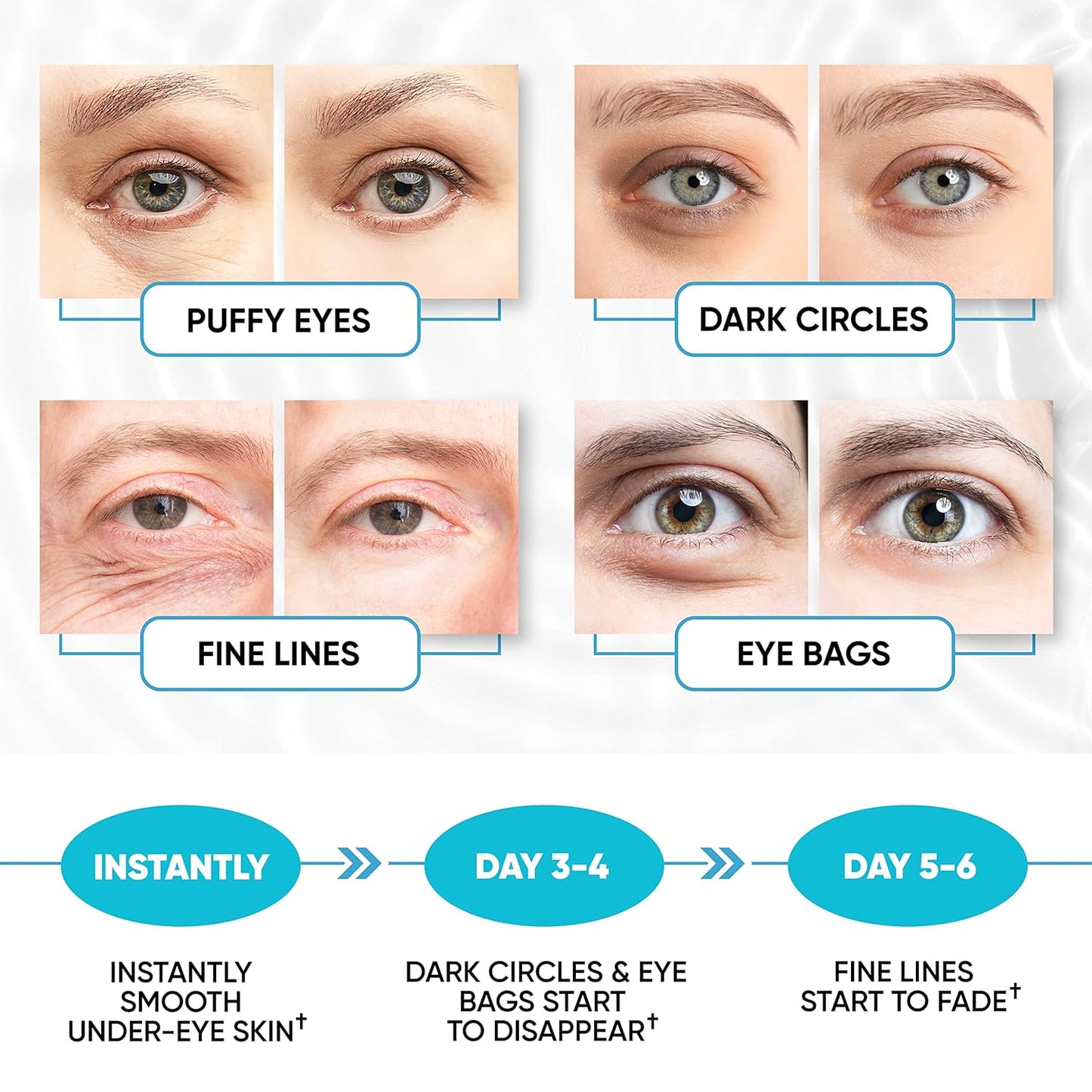 Under Eye Patches for Puffy Eyes, Dark Circles, Dull Skin - Natural Moisturizing Support - Help with Wrinkles and Fine Lines - Under Eye Mask with Hyaluronic Acid, Collagen, Caffeine - 30 Pairs