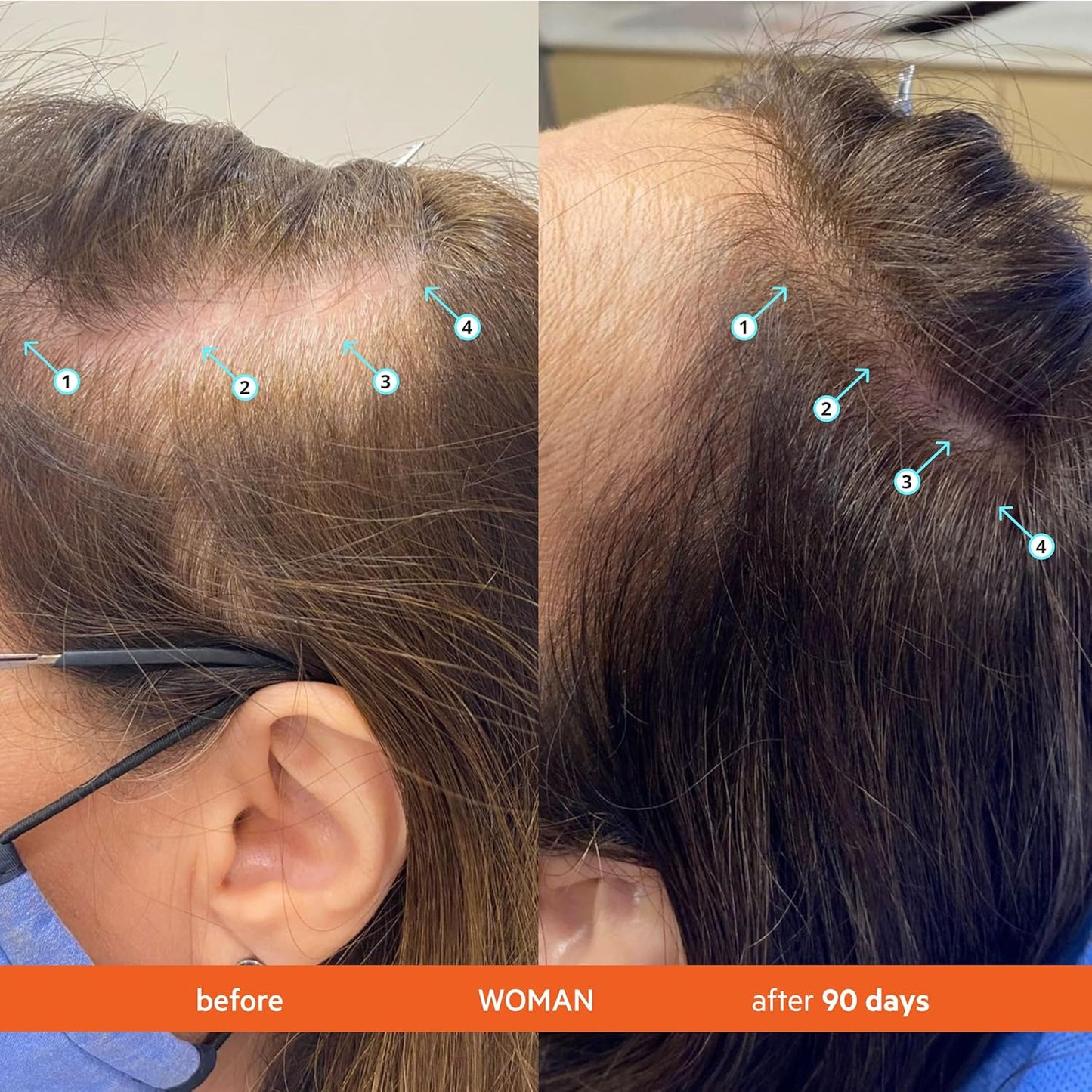 DS Labs Revita Conditioner, 205mL - Lightweight, Scalp First Hydration for Fuller Looking, Softer Hair, Thickening Appearance, Sulfate & Silicone Free, Color Safe, For Men & Women