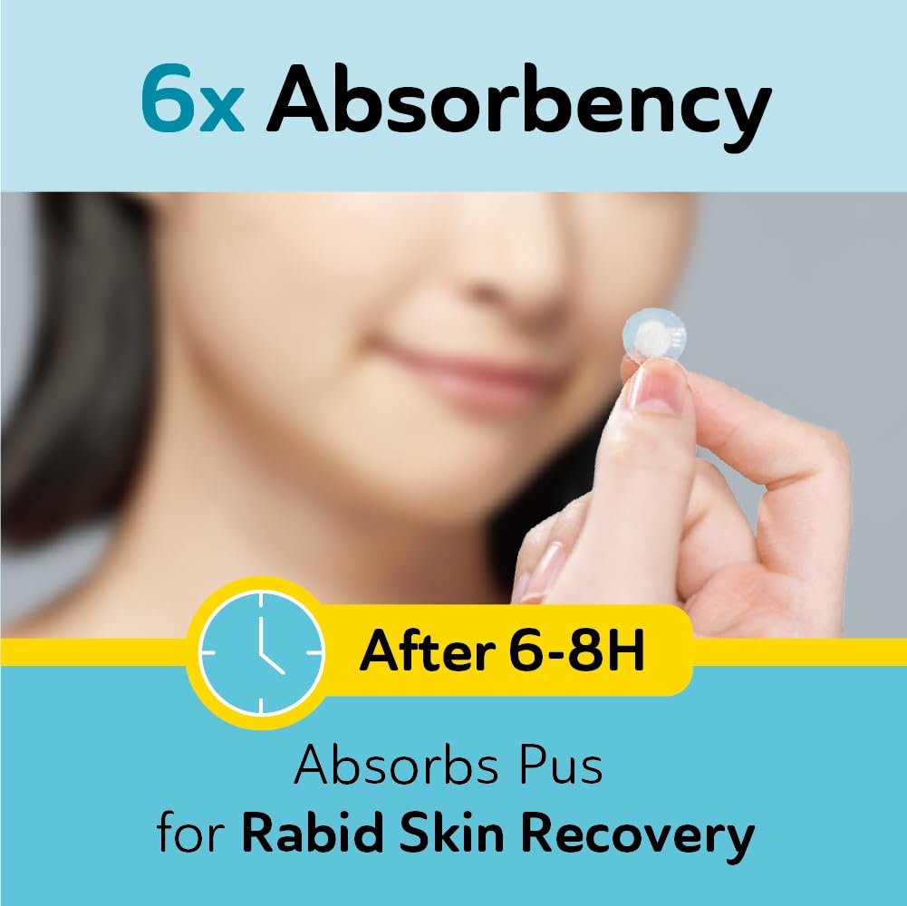 Invisible Pimple Patches for Cystic Acne - Premium Hydrocolloid Acne Patches & Zit Stickers, Cystic Acne Patch with Matte Finish - 240 Count - 3 Sizes Invisible Plus (Clear Patch)