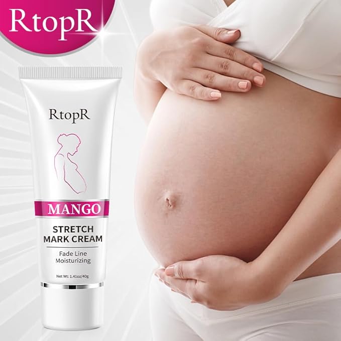 RtopR Mango Stretch Mark Cream for Pregnancy, Stretch Mark Repair Cream, Fade Line, Moisturizing and Non-Greasy, Safe to Use When Pregnant