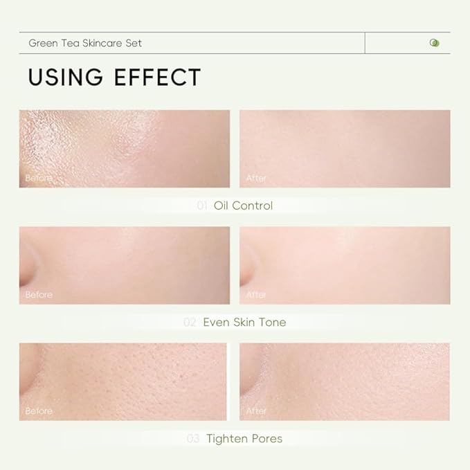 Skin Care Set, Green Tea Skin Care Sets & Kits, Skin Care for Teenage Girls Gift Set with Cleanser, Toner, Serum, Eye Cream, Facial Cream, Facial Skin Care Sets & Kits for Teenage Girls Women