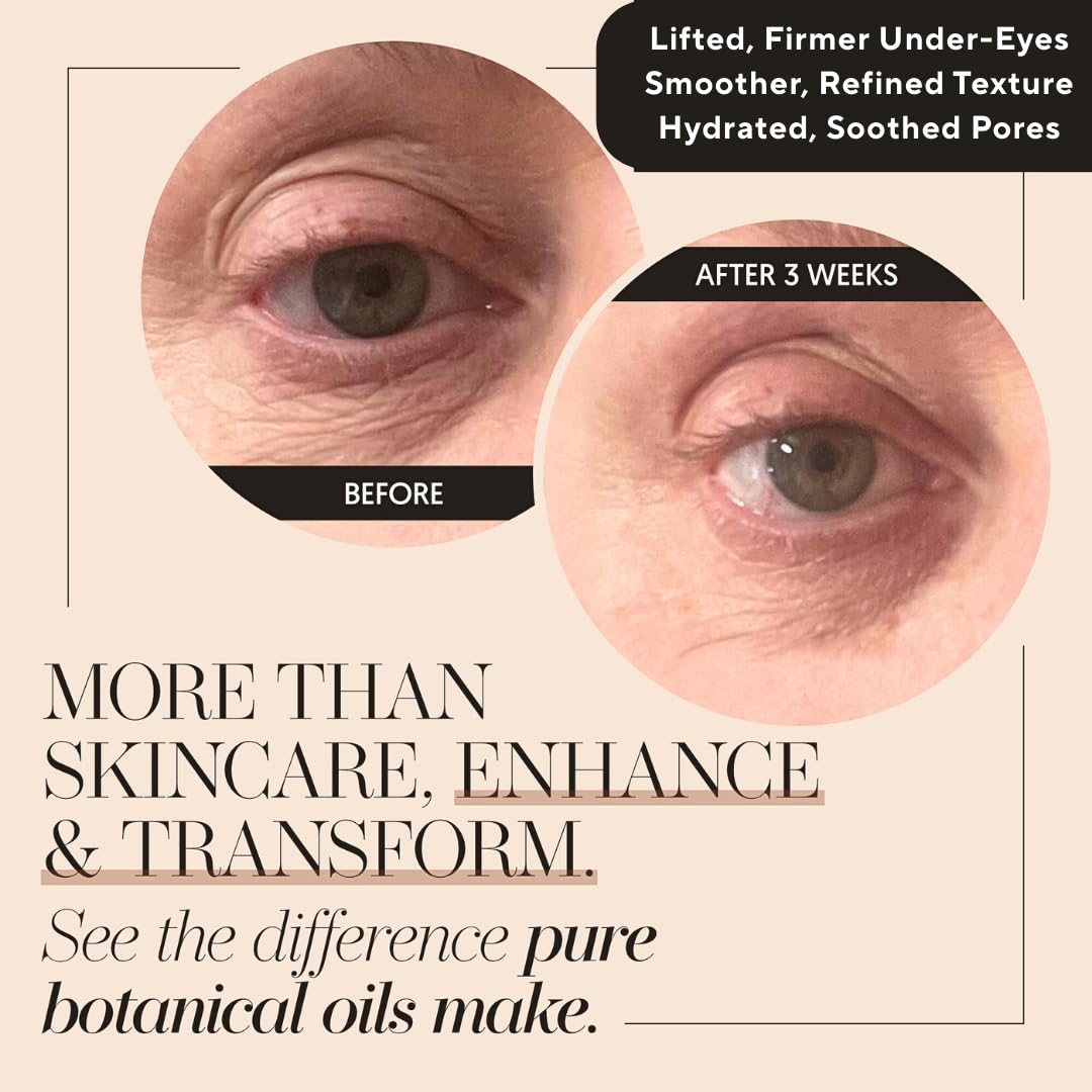 100% Organic Tsubaki Face Oil & Under-Eye Serum. Jojoba, Calendula, & Rice Bran - Hydrating & Brightening for Glowing Skin, Dark Spots & Even Skin Tone, Moisturizing Anti Aging Serum by Finally