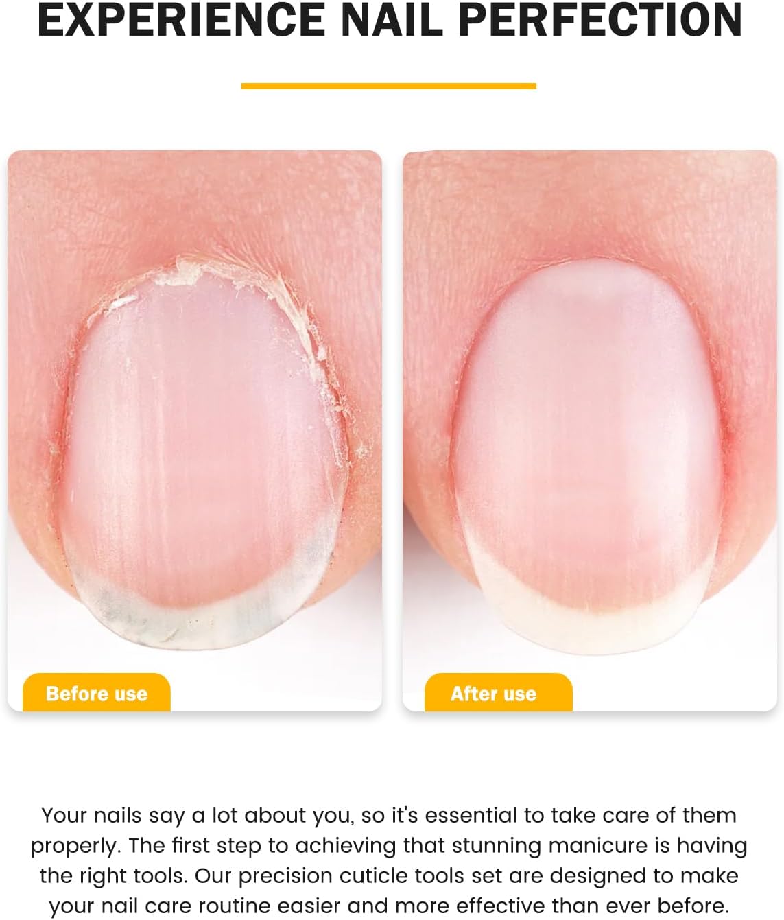 BEZOX Cuticle Trimmer with Pusher - Salon Quality Cuticle Clipper with Cuticle Pushers, Super Sharp Cuticle Cutters and Dual-End Nail Pushers Cuticle Stick, Professional Manicure Tools - Rainbow