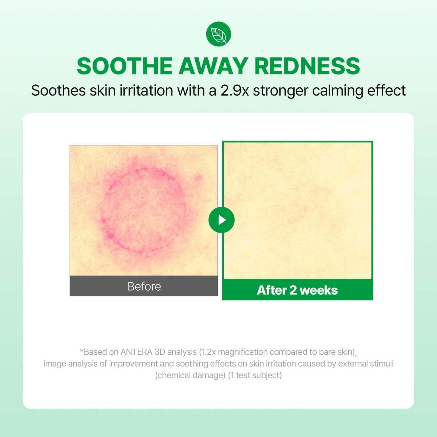 MAKE P:REM INTECA Soothing Cream, Quick Calming Facial Cream with Advanced CICA for Acne-Prone Skin, All Skin Types, EVE VEGAN, Korean Skin Care, 2.70 fl.oz., 80ml