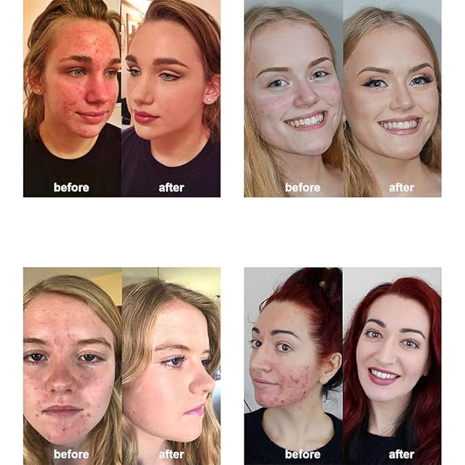 2 Pack PHOERA Foundation Makeup For Older Women,Flawless Soft Matte Liquid Foundation 24 HR Oil Control Concealer Foundation Makeup(101 Porcelain+102 Nude)