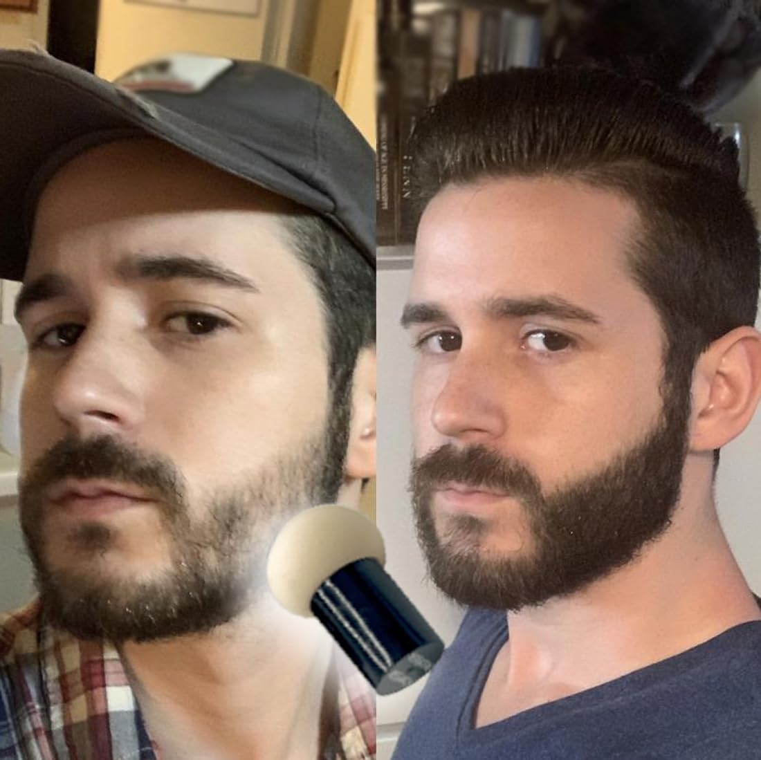 KERATIN RESEARCH Hairline Filler Unisex Mineral Powder Root Touch-Up Hair loss Concealer Scalp & Beard Bald Patch Coverage Fibers for Thinning Hair Waterproof Organic Natural look (DARK ASH BROWN, XL)