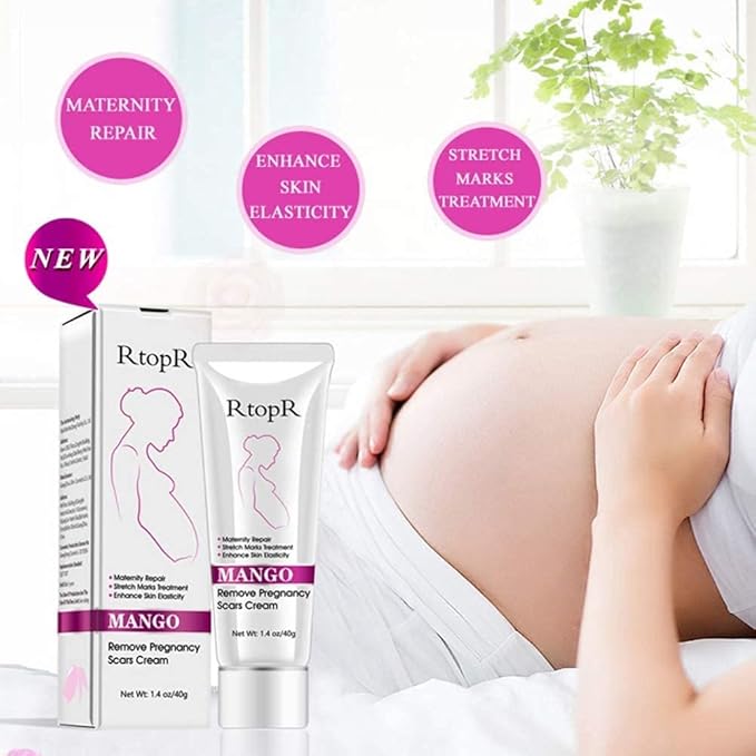 RtopR Mango Stretch Marks and Scar Cream -Stretch Marks and Scar Removal Cream for Pregnancy - Best Body Moisturizer-80g