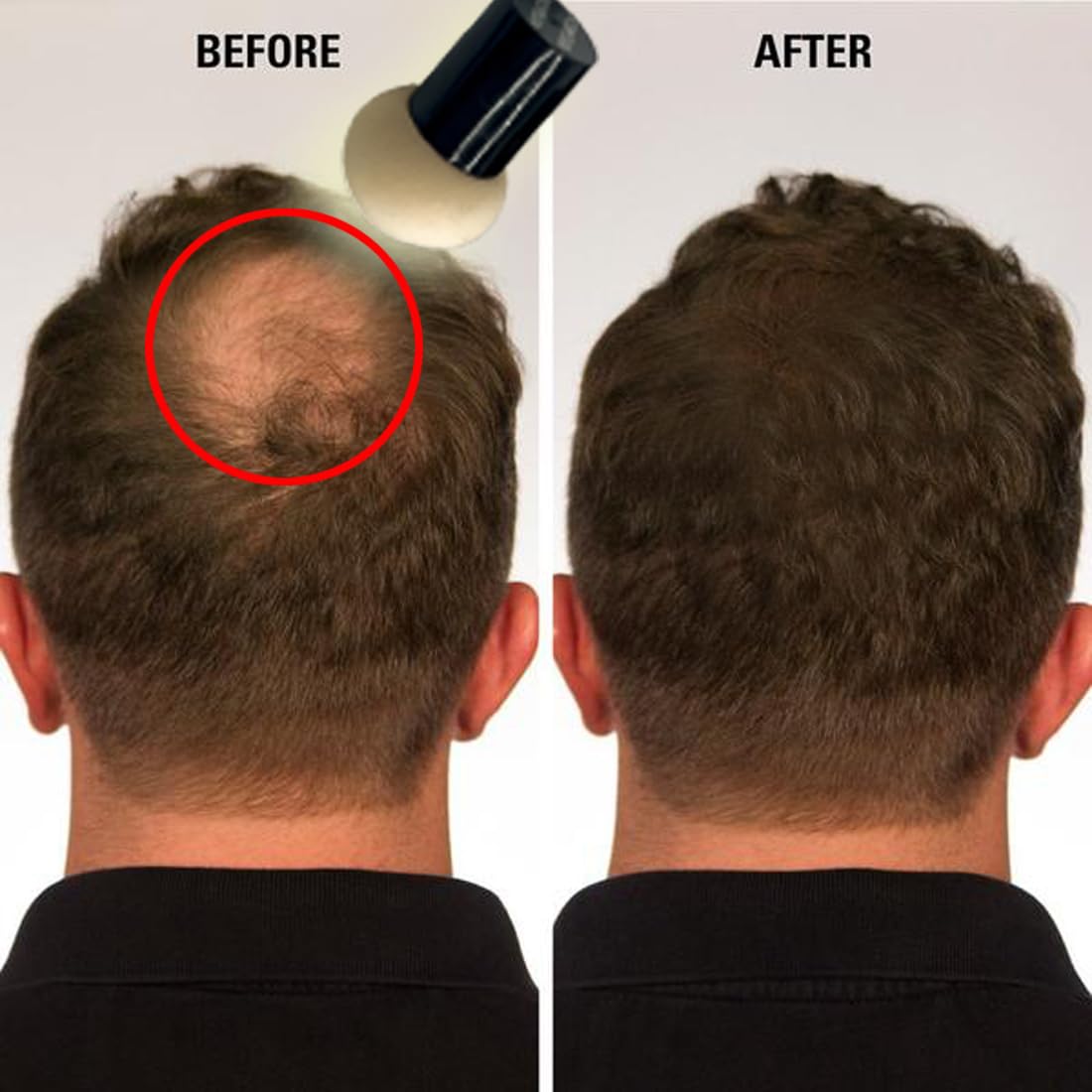 KERATIN RESEARCH Hairline Filler Unisex Mineral Powder Root Touch-Up Hair loss Concealer Scalp & Beard Bald Patch Coverage Fibers for Thinning Hair Waterproof Organic Natural look (DARK ASH BROWN, XL)