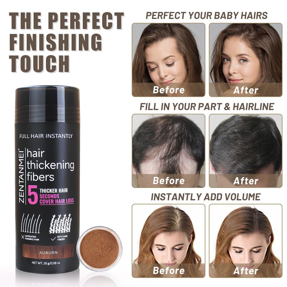 Hair Fibers for Thinning Hair for Women All-Natural Hair Building Fibers 0.98 Oz Hair Volume Powder Bald Spot Cover Up for Men & Women (Auburn)