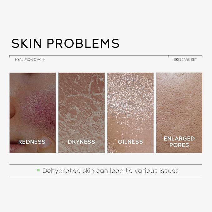 Hyaluronic Acid Skin Care Set, Hydration Kit for Women Teen Girls, Low pH Cleanser, Moisturizer, Serum, Eye Cream, Anti Aging, Firming, Travel Size Facial Care Gift Set for Dry Sensitive Skin