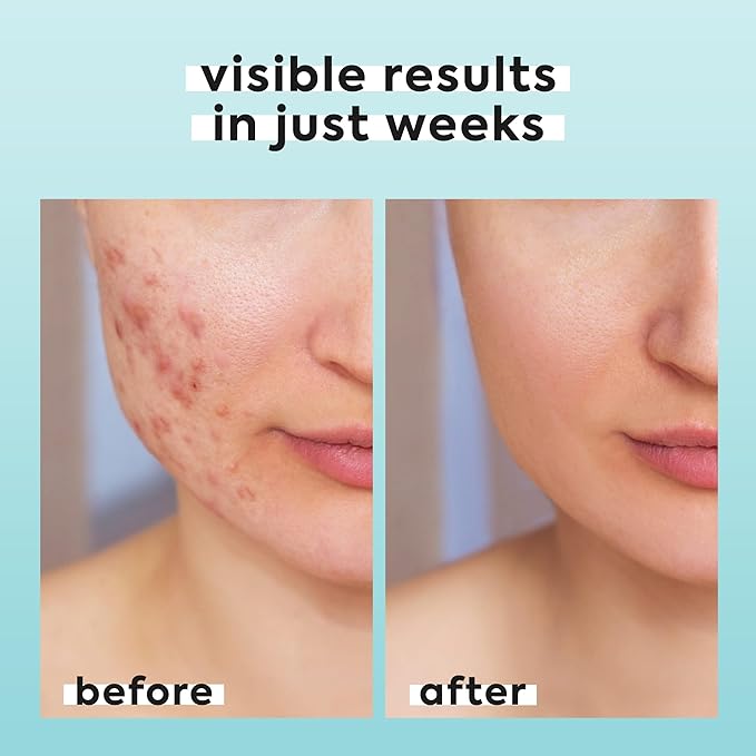 Hypochlorous Acid Spray for Face & Body - Helps Reduce Redness and Breakouts - Travel Size Hypochlorous Spray, Multi-Purpose Topical Facial Skin Repair, pH-Balancing Toner - TSA, Livaclean