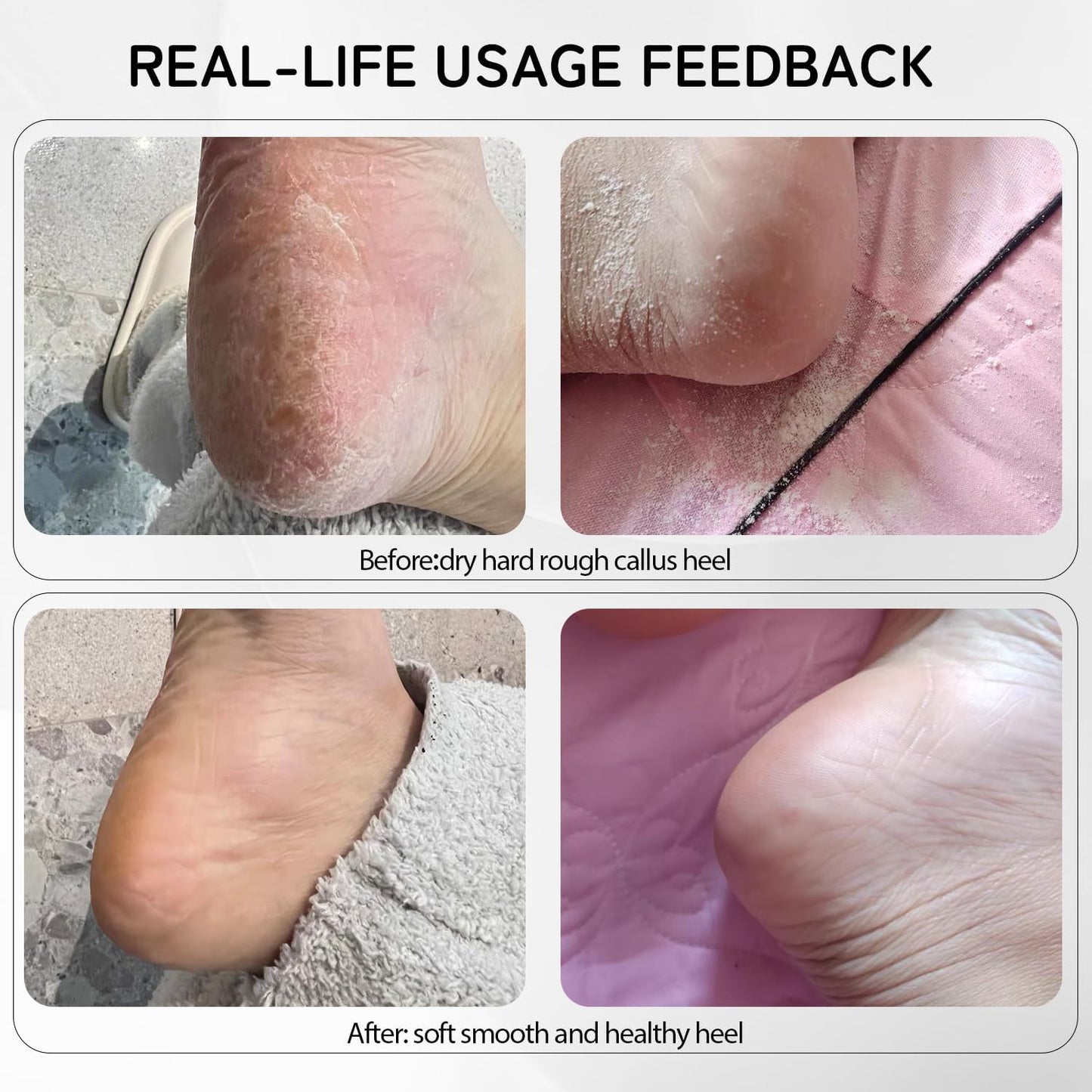 Cordless Electric Foot Callus Remover,Rechargeable Grinder Tool for Feet Dead Skin,Professional Pedicure File Heel Sander Tools with 60pcs Sandpaper Pads(Black)