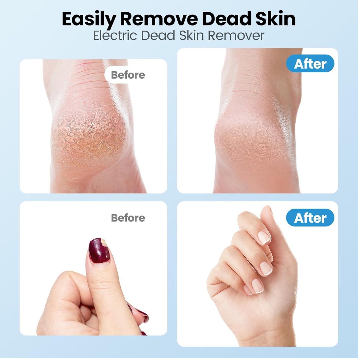 Electric Callus Remover for Feet, 2 in 1 Electric Foot File Grinder, Rechargeable Cordless Foot Scrubber for Dead Skin, Adjustable Speed with Sandpaper Discs, Professional Pedicure Tools,White