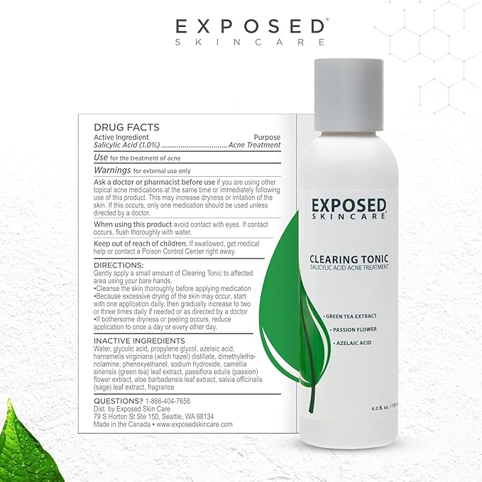 Exposed Skin Care Acne Treatment Kit - Includes Facial Cleanser, Clearing Tonic, Acne Treatment Serum, Clear Pore Serum, Clarifying Mask, Cloth - Natural Acne Solution for Face, All Ages & Skin Types
