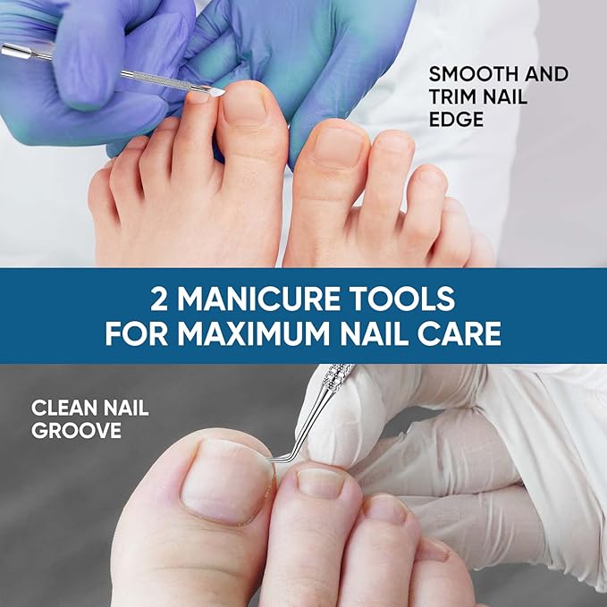 Ingrown Toenail Treatment, 60Pcs Ingrown Toenail Corrector Strips, Ingrown Toenail Removal Kit with File and Lifter, 60Pcs