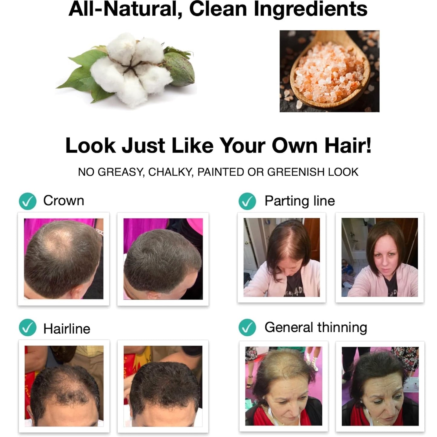 Caboki Hair Loss Concealer. All-Natural Hair Building Fiber. Make Thin Hair Look 10X Fuller Instantly. Eliminate the Appearance of Bald Spot and Thinning Hair (30G, 90-Day Supply). BLONDE