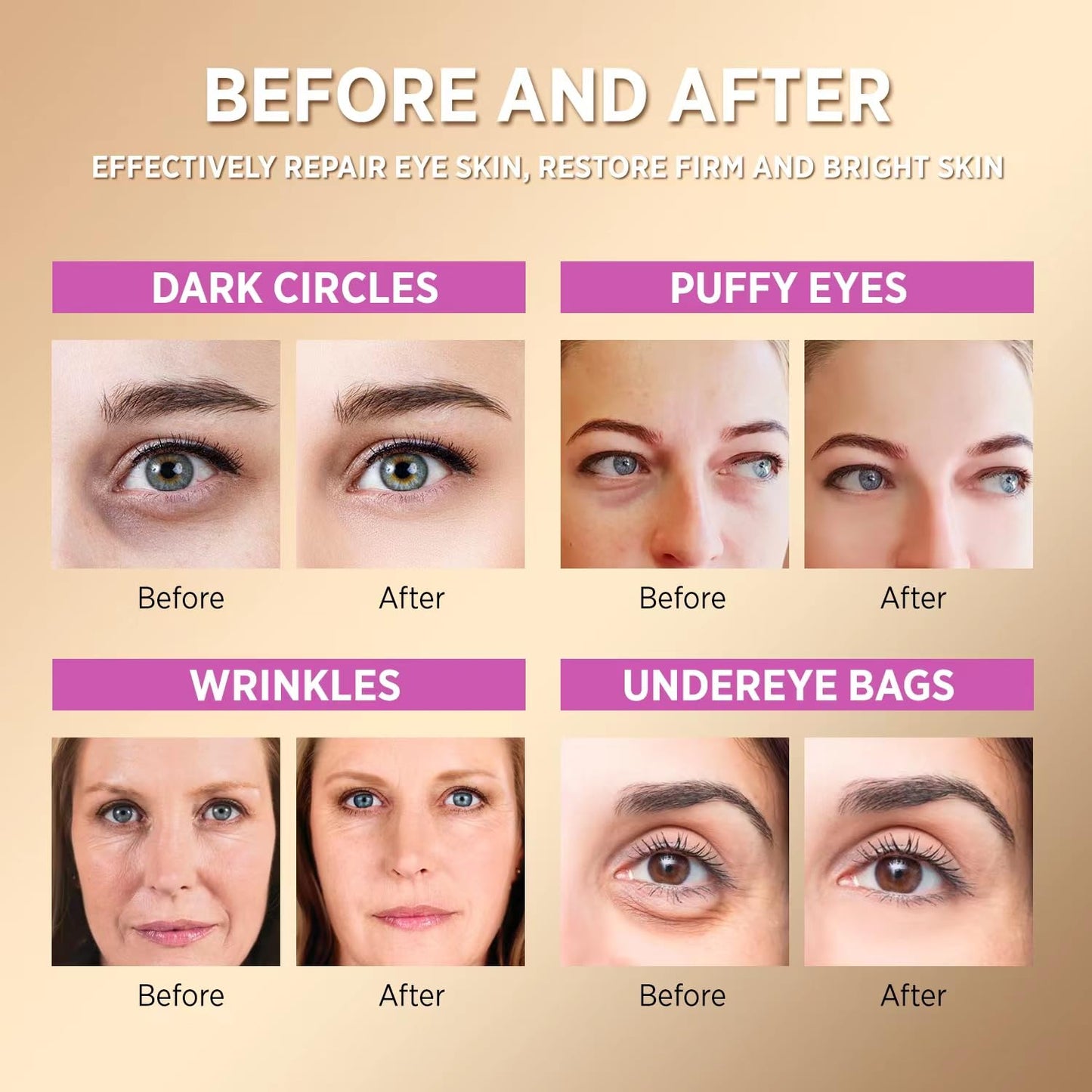 Under Eye Patches for Dark Circles: Anti-Wrinkle Eye Cream with Hyaluronic Acid - Reduce Under Eye Bags