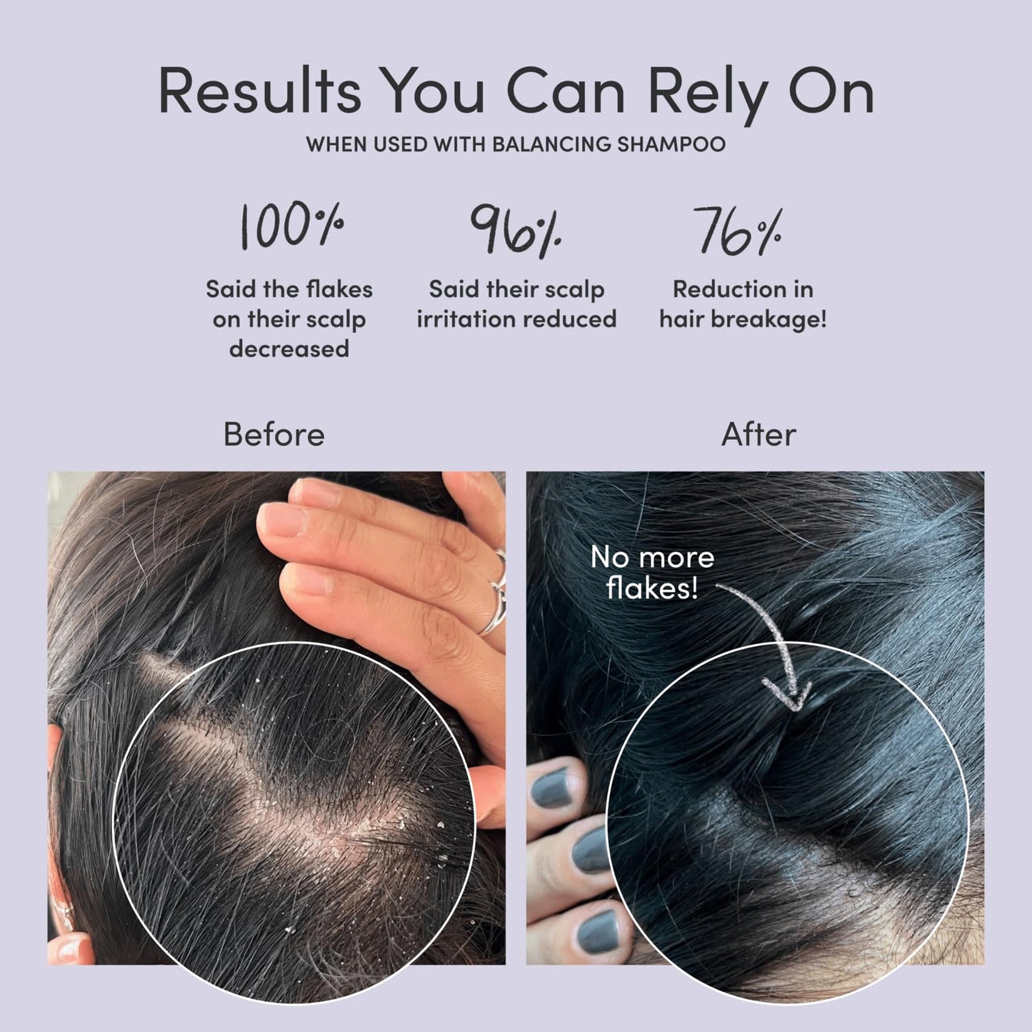 Jupiter Restoring Scalp Serum - Soothing Anti-Dandruff Serum for Men & Women for Flaky, Oily, & Dry Scalp - Restores Barrier and Reduces Breakage & Flakes - Color-Safe, Sulfate-Free, Paraben-Free