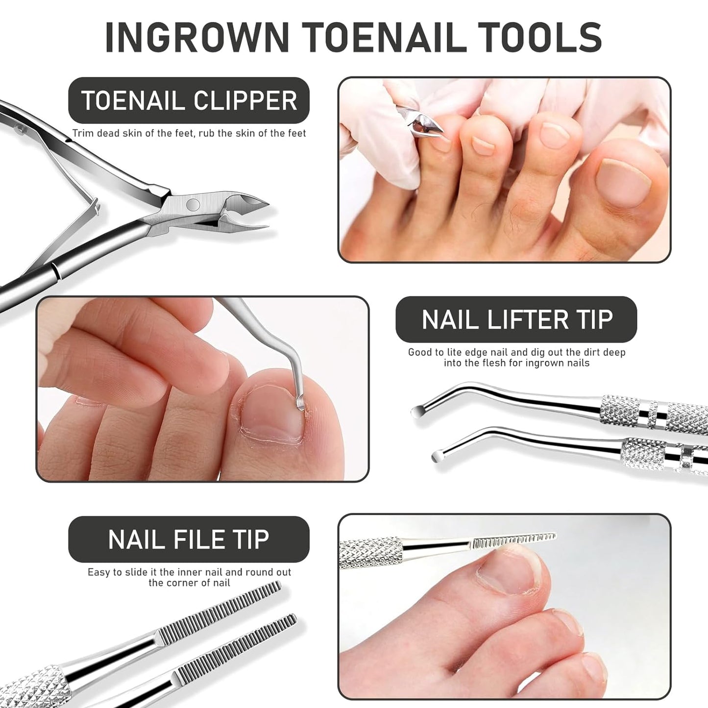 Ingrown Toenail Tool Kit, Ingrown Toenail Removal Kit: Ingrown Toenail Clippers, Ingrown Toenail File and Lifters, Under Nail Cleaner - Professional Pedicure Tools Set for Effective Treatment