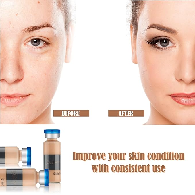 BB Facial Glow Starter Kit Facial Pigment Serum Treatment Kit,Anti-Aging Serum Pigments Set for Micro-needling Skin Treatment 10 Vials 5ml Hyaluronic Acid Ampoule foundation Essence Skin