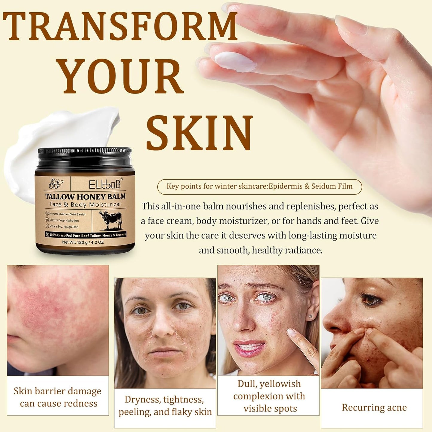 Whipped Tallow Cream for Face & Body - 100% Grass-Fed Beef Tallow, Natural Honey & Beeswax Moisturizer, Deep Hydration & Nourishment, Oil-Free & Unscented, Fast Absorbing