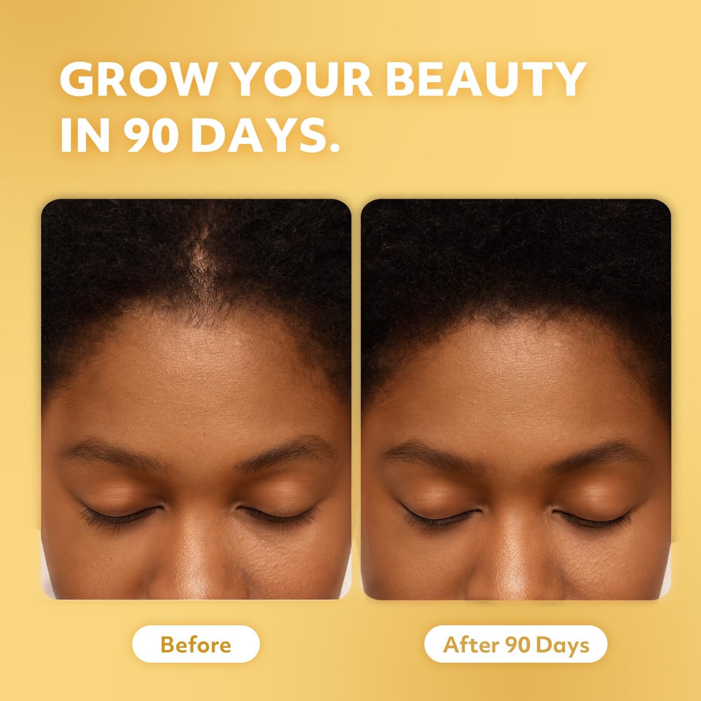 AAA (African Anti-Aging) 100% Natural Honduras Batana Oil – Supports Hair Growth, Repairs Damaged Hair, Moisturizes Dry Scalp & Skin – Made in USA 1.7 fl oz – For All Hair&Skin Types