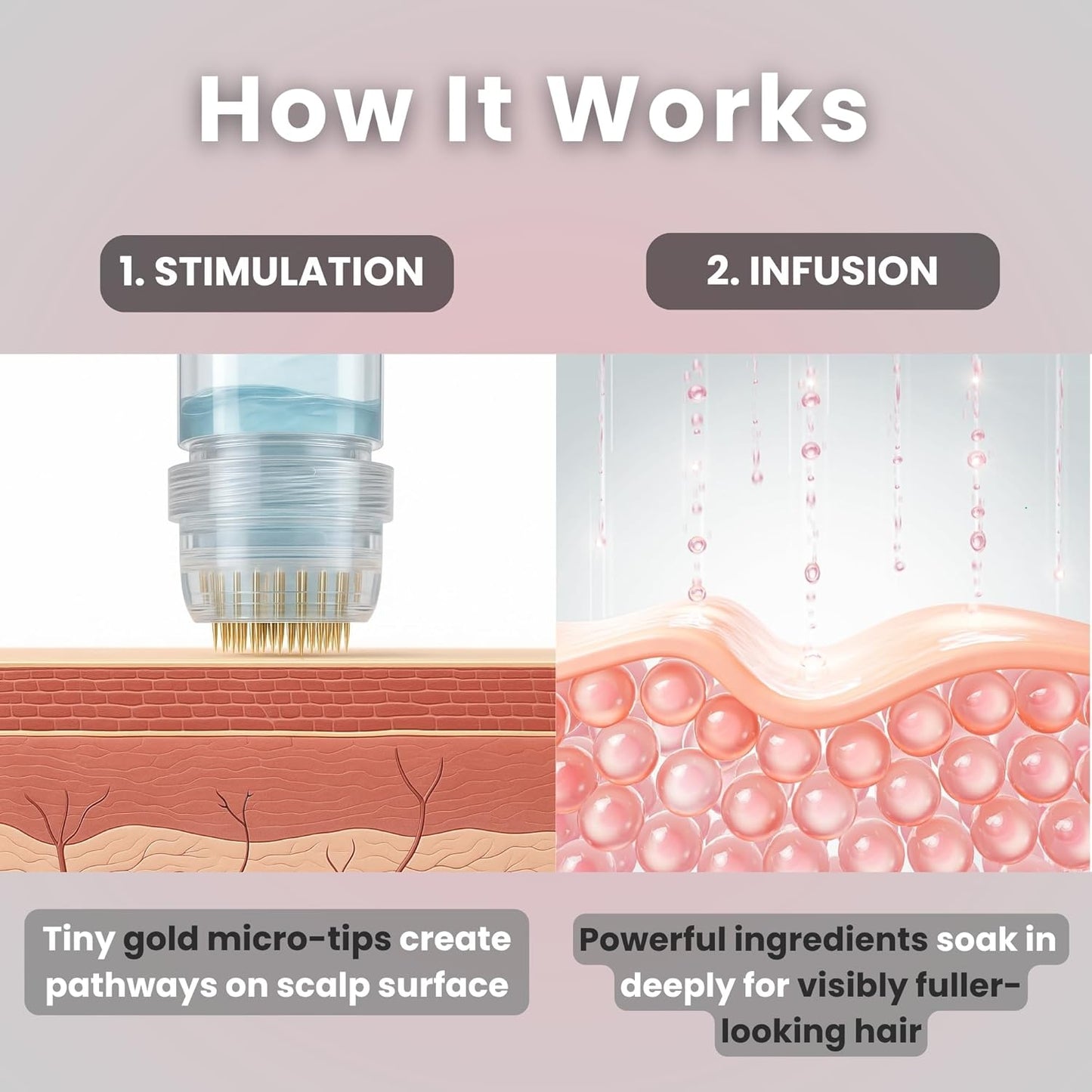 Micro Infusion Hair Renewal Kit - with Hyaluronic Acid, Peptide & Botanical Serum Ampoules - Helps Promote Fuller, Hydrated Strands - 0.25mm Stamp for Scalp Care