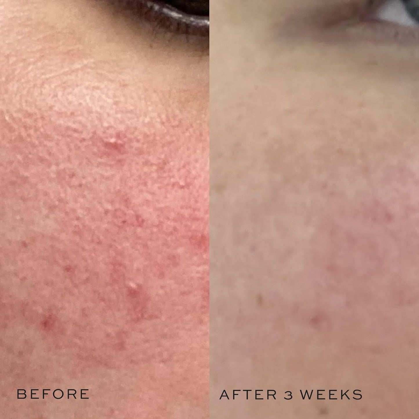 DIME Beauty Mini Super Skin Toner, Alcohol-Free Witch Hazel Toner, Travel-Size Toner with Cucumber Extract, 2 oz / 60 ml