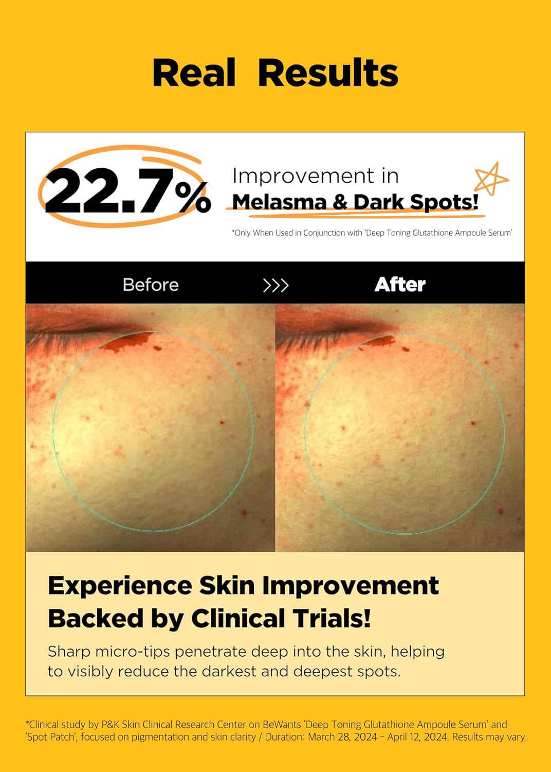 Bewants Deep Toning Glutathione Spot Patch – Micro Tip Patches for Skin Elasticity, Texture & Blemish Care, 9 Patches