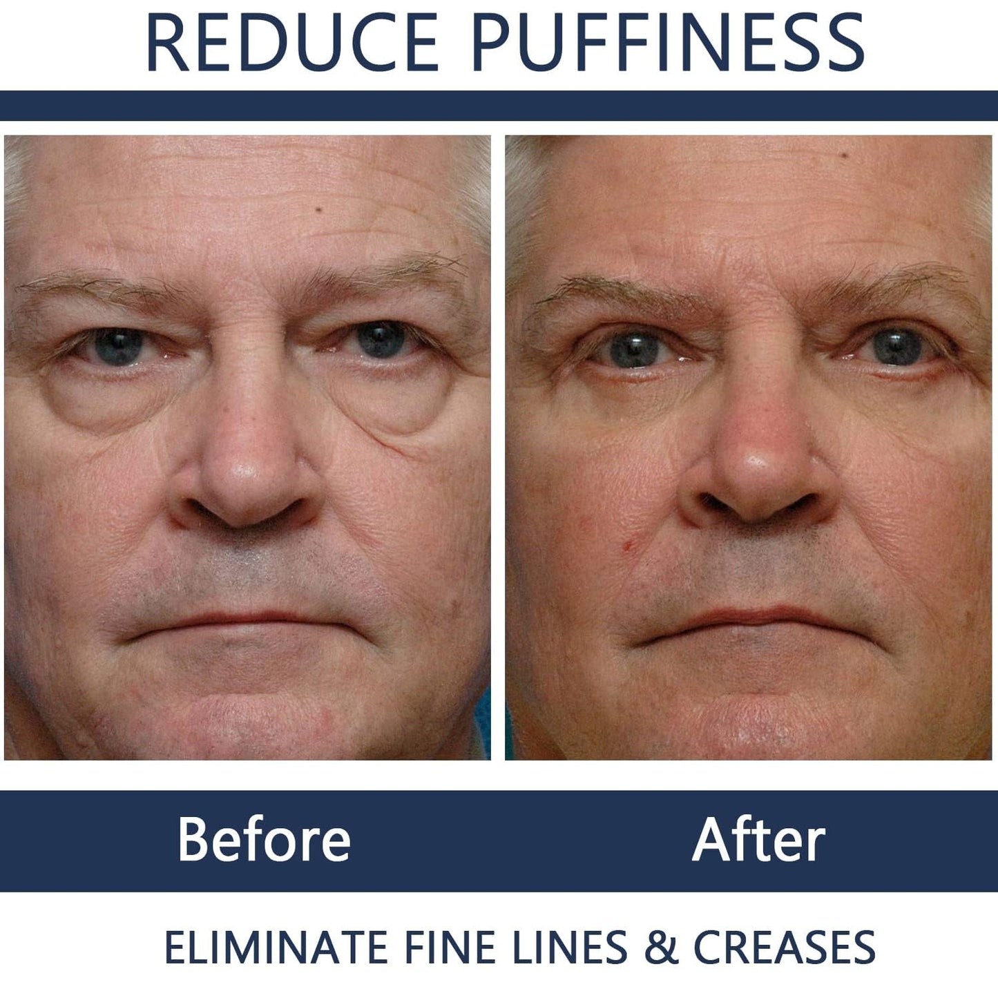 Men Eye Cream Anti Aging,Himse Awaken Peptide Depuffing Eye Gel,Men's Moisturizing Eye Cream Remove Eye Bags,Wrinkles,Fine Lines,Dark Circles,Puffiness and Bags Under Eyes (2PCS)