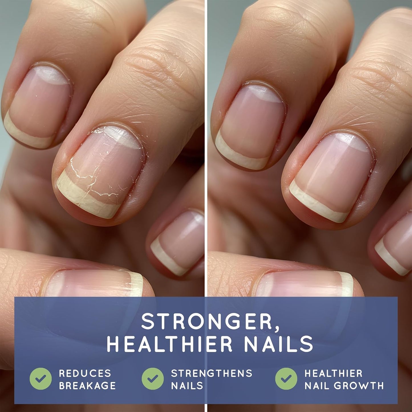 Biotin (Biotina Vitaminas) - Hair Skin Nails Vitamins for Women & Men - 5000 mcg - Hair Growth Support Supplements - 90 Tablets - with Revytalyz 5, Vitamin A, C, B12 - Made in USA