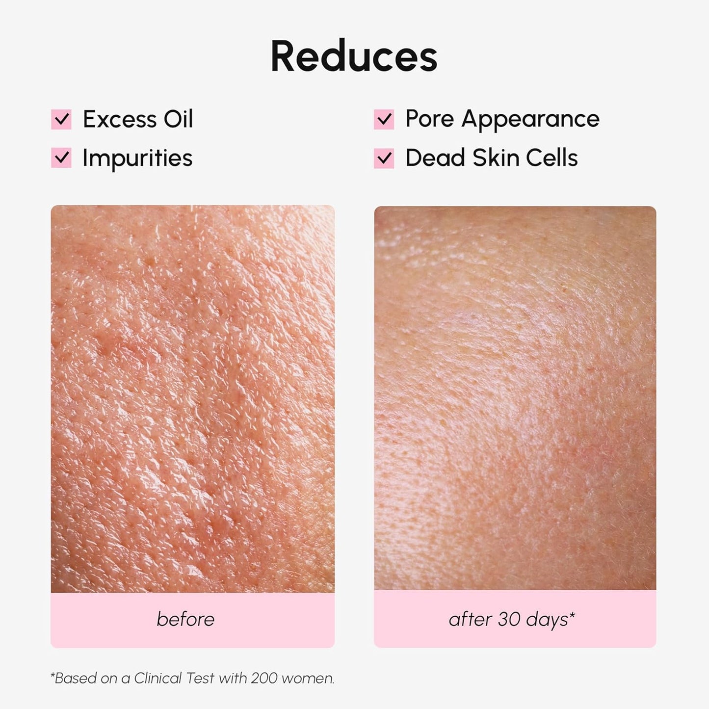 MAREE Pore Minimizer for Face Toner – Oil Control Facial Toner with Niacinamide, Witch Hazel & Marine Collagen – Gentle Exfoliating Face Toner for Women – Oily, Normal, Sensitive Skin – Tonico Facial