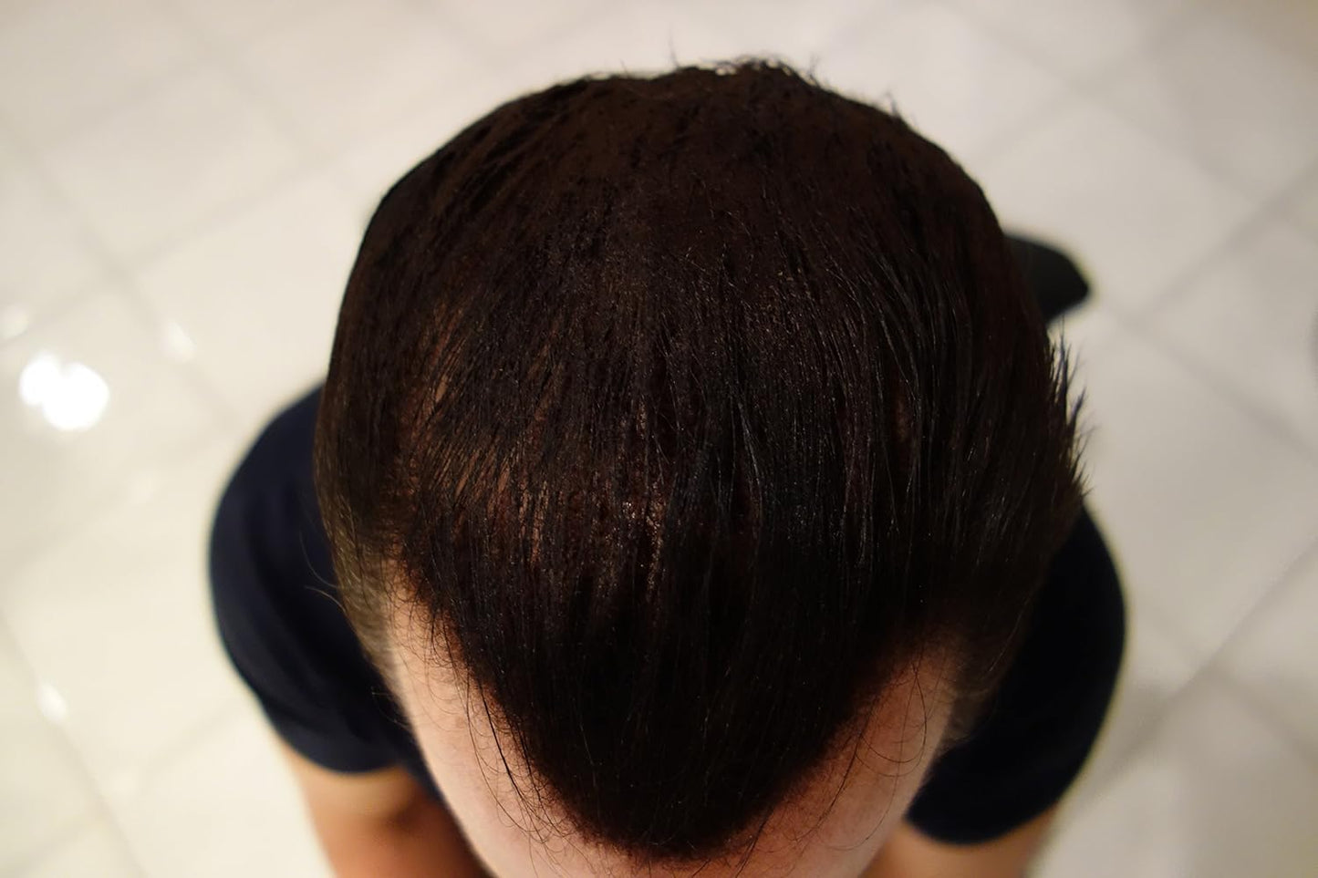 Hair Building Fibers 200 Grams 7 Oz. With Bottle By Finally Hair 50g*4 (Dark Grey (dark gray))