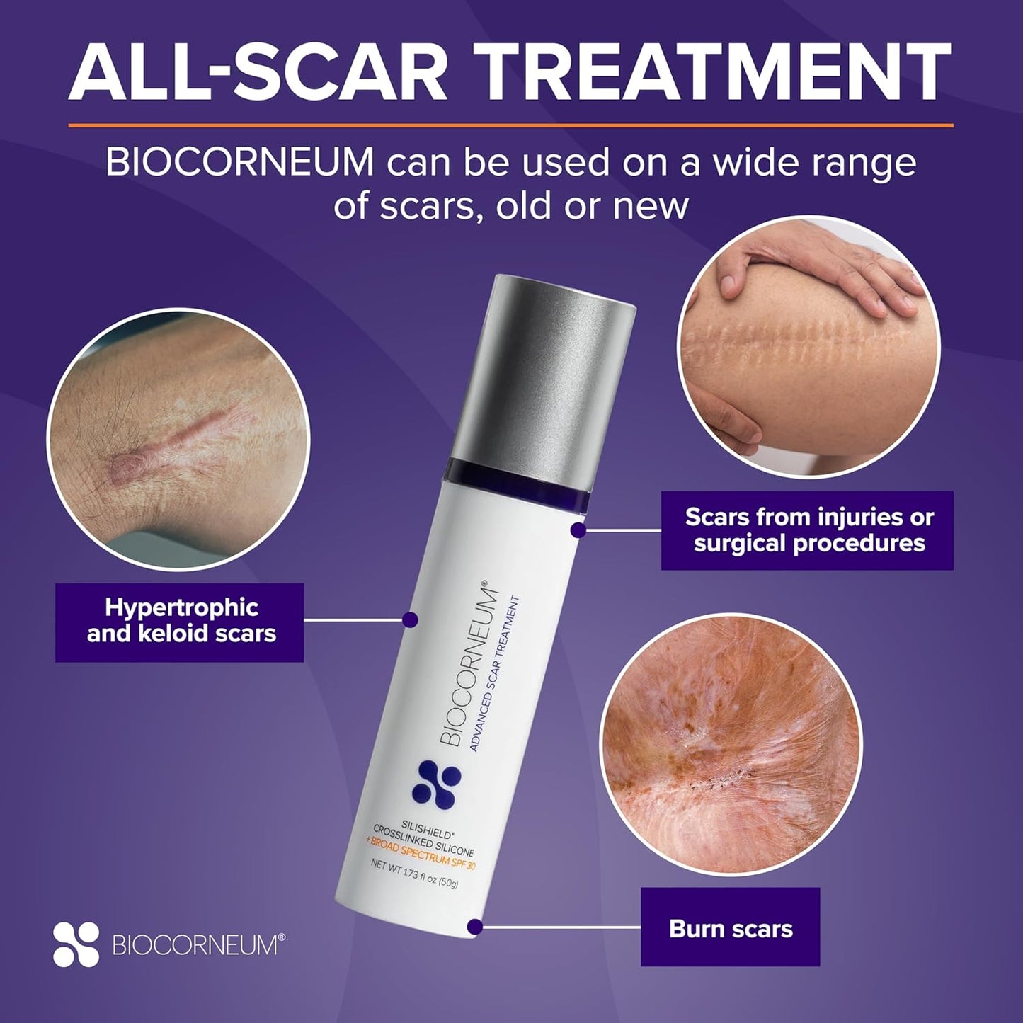 Biocorneum Advanced Scar Treatment with Silishield® & SPF 30 10g – Made in the USA, Fast-Drying, Silicone Scar Gel - Surgeon Recommended for New & Old Scars - Suitable for Children Over 6 Months