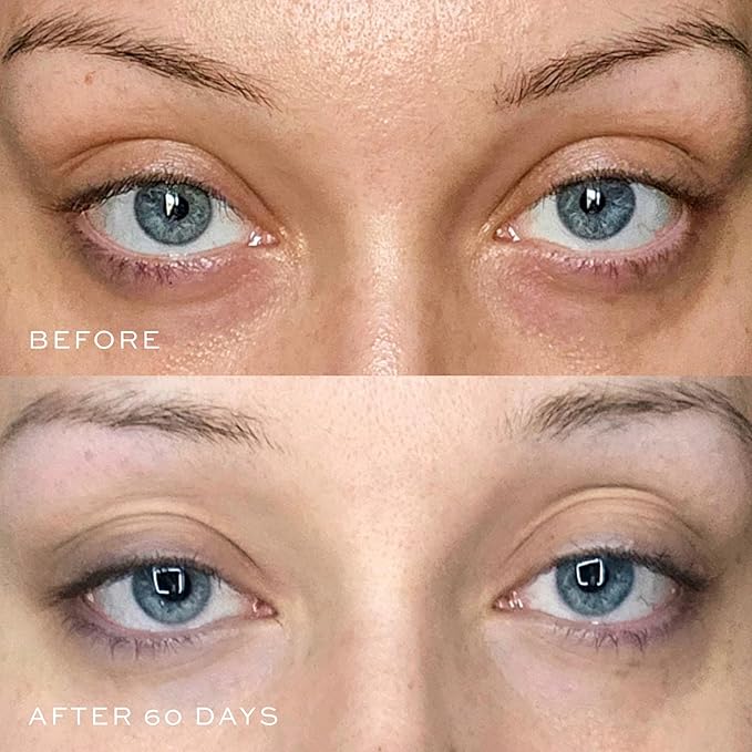 DIME Beauty Luminosity Eye Serum, Eye Cream for Dark Circles and Puffiness, Caffeine Eye Cream, Puffy Eyes Treatment, 0.5 oz / 15 mL