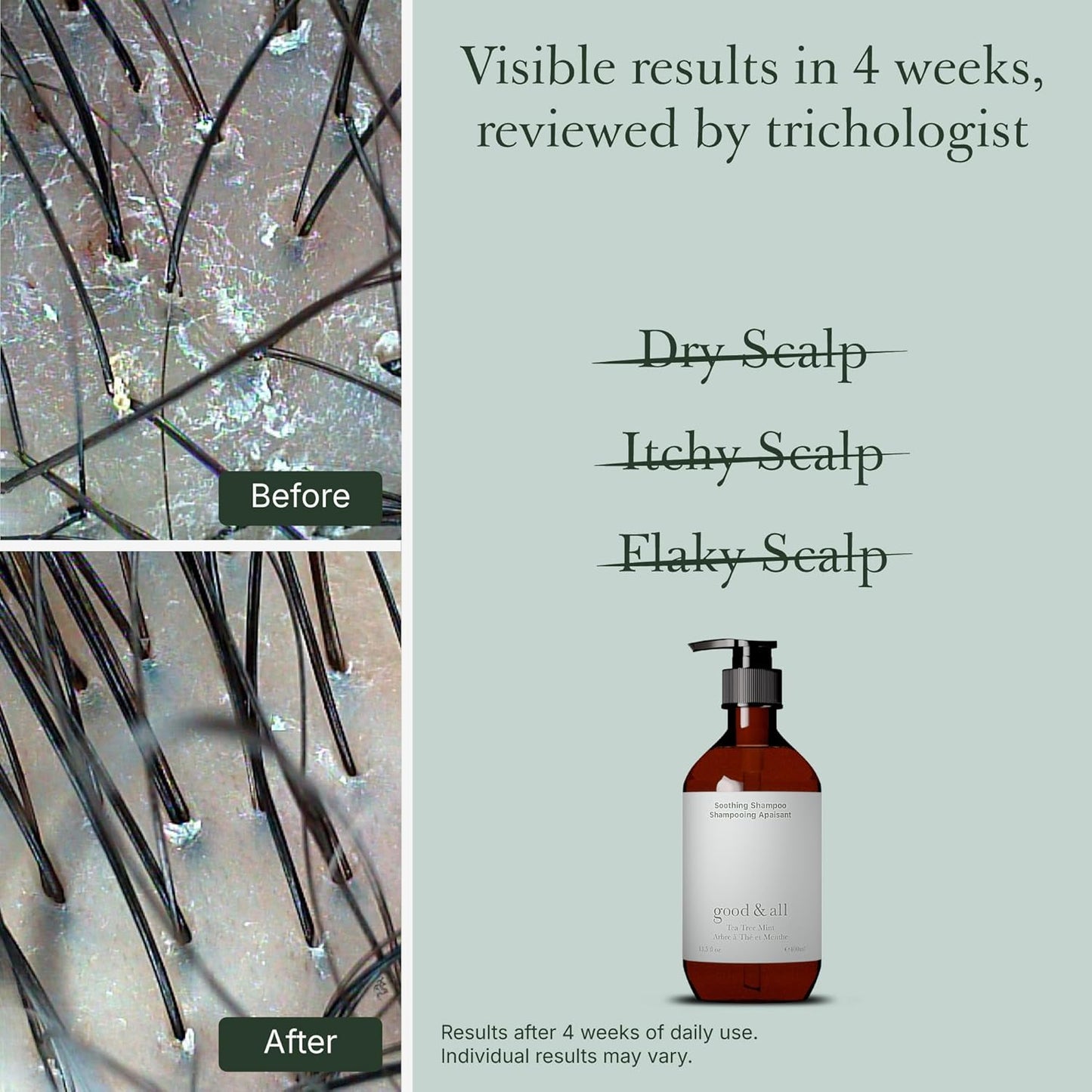 GOOD&ALL Tea Tree Shampoo for Dry Itchy Scalp with Peppermint - Sodium Lauryl Sulfate/Sulphate, Silicone, Paraben, Fragrance Free - 13.5 fl oz