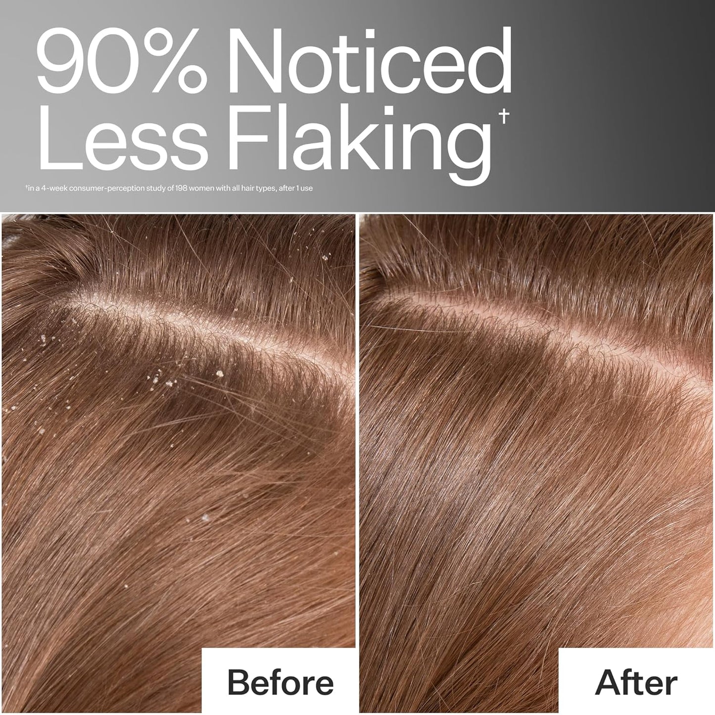 ACT+ ACRE Cold Processed Scalp Detox Oil - Sulfate-Free Care for Flaky, Dry and Itchy Scalp - Promotes Thicker, Fuller-Looking Hair